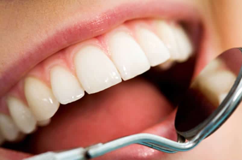 up close of dentist observing patient's upper teeth with mirror