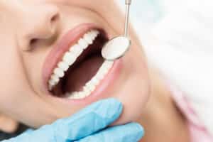 BIOLASE® Procedure Pasadena TX