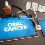 An iPad that says "Oral Cancer"