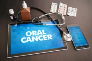 An iPad that says "Oral Cancer"