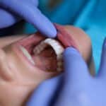 A dentist performing an oral cancer screening in Pasadena, TX